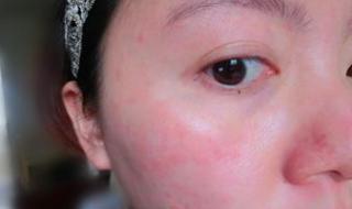 全国花粉过敏预警地图 全国花粉过敏预警地图